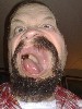 Huppen